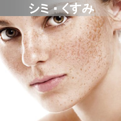 Eライト対応メニュー　シミ・くすみ