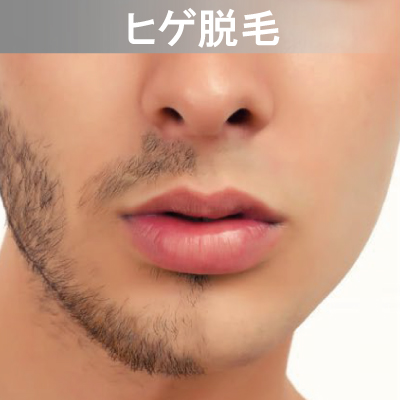 Eライト対応メニュー　ヒゲ脱毛