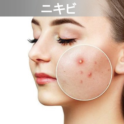 Eライト対応メニュー　ニキビ