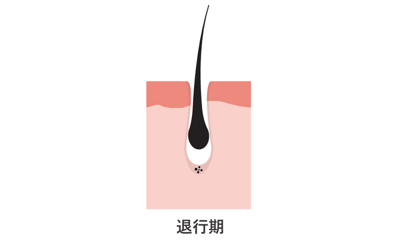 毛周期の退行期